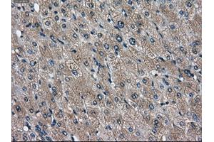 Immunohistochemical staining of paraffin-embedded liver tissue using anti-DPP4mouse monoclonal antibody. (DPP4 抗体)