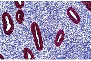 Human Uterus: Formalin-Fixed, Paraffin-Embedded (FFPE) (Keratin Basic 抗体)