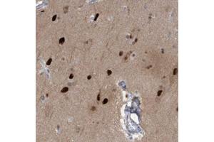 Immunohistochemical staining of human cerebral cortex with SOX7 polyclonal antibody  shows strong nuclear positivity in neuronal cells at 1:50-1:200 dilution. (PINX1 抗体)