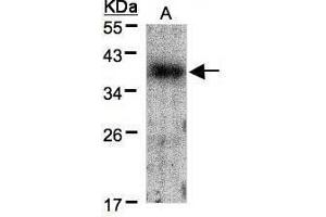 WB Image Sample(30 μg of whole cell lysate) A:A431, 12% SDS PAGE antibody diluted at 1:1500 (Crk 抗体  (Center))