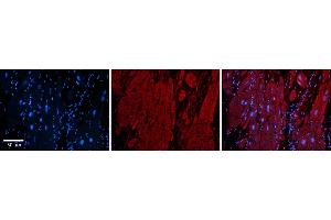 Rabbit Anti-ZFP36L1 Antibody  Catalog Number: ARP33382_P050 Formalin Fixed Paraffin Embedded Tissue: Human Adult heart  Observed Staining: Cytoplasmic Primary Antibody Concentration: 1:600 Secondary Antibody: Donkey anti-Rabbit-Cy2/3 Secondary Antibody Concentration: 1:200 Magnification: 20X Exposure Time: 0. (ZFP36L1 抗体  (N-Term))