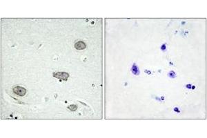 Immunohistochemistry analysis of paraffin-embedded human brain, using CSFR (Phospho-Tyr809) Antibody. (CSF1R 抗体  (pTyr809))