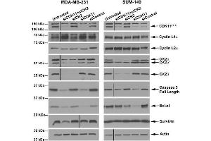 Western Blotting (WB) image for anti-Cyclin L2 (CCNL2) (AA 309-384) antibody (ABIN6655712)