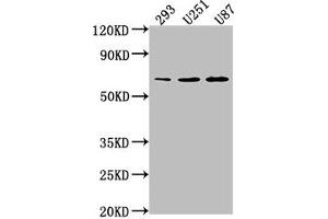 Western Blot Positive WB detected in: 293 whole cell lysate, U251 whole cell lysate, U87 whole cell lysate All lanes: TCF7L1 antibody at 1:1000 Secondary Goat polyclonal to rabbit IgG at 1/50000 dilution Predicted band size: 63 kDa Observed band size: 63 kDa (TCF7L1 抗体  (AA 80-99))