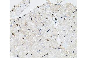 Immunohistochemistry of paraffin-embedded Mouse heart using GTF2H2 Polyclonal Antibody at dilution of 1:100 (40x lens). (GTF2H2 抗体)
