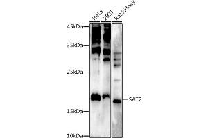 Western blot analysis of extracts of various cell lines, using  at 1:500 dilution. (SAT2 抗体  (AA 1-170))