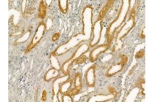 ABIN6262070 and ABIN6276489 at 1/100 staining human normal kidney tissue by IHC-P.