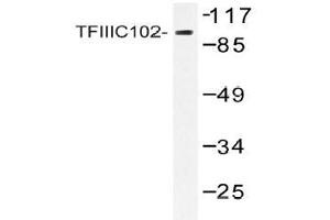 Western blot (WB) analysis of TFIIIC102 antibody in extracts from 293 cell.
