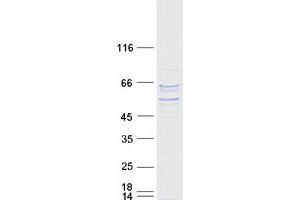 P4HA2 Protein (Transcript Variant 2) (Myc-DYKDDDDK Tag)