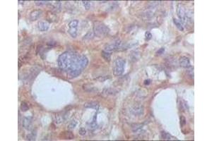 Immunohistochemistry (IHC) image for anti-serine/threonine/tyrosine Kinase 1 (STYK1) (truncated) antibody (ABIN2464109) (STYK1 抗体  (truncated))