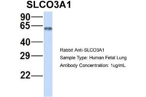 Host:  Rabbit  Target Name:  SLCO3A1  Sample Type:  Human Fetal Lung  Antibody Dilution:  1. (Solute Carrier Organic Anion Transporter Family, Member 3A1 (SLCO3A1) (Middle Region) 抗体)