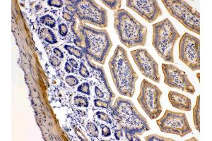 DR5 was detected in paraffin-embedded sections of mouse intestine tissues using rabbit anti- DR5 Antigen Affinity purified polyclonal antibody (Catalog # ) at 1 µg/mL. (TNFRSF10B 抗体  (AA 233-440))