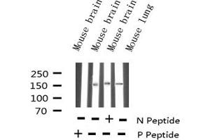 Western blot analysis of Phospho-Bcr (Tyr177) expression in various lysates (BCR 抗体  (pTyr177))