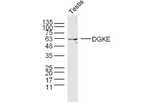 Mouse testis lysates probed with DGKE Polyclonal Antibody, unconjugated  at 1:300 overnight at 4°C followed by a conjugated secondary antibody at 1:10000 for 90 minutes at 37°C. (DGKE 抗体  (AA 1-100))