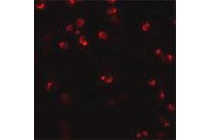 Immunofluorescence staining of human spleen tissue with 20 ug/mL NLRP3 polyclonal antibody . (NLRP3 抗体  (AA 120-170))