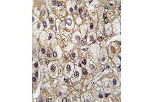 Immunohistochemistry (Paraffin-embedded Sections) (IHC (p)) image for anti-Cytochrome P450, Family 2, Subfamily C, Polypeptide 9 (CYP2C9) (AA 235-265) antibody (ABIN392364)