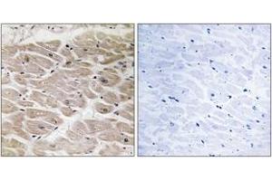 Immunohistochemistry (IHC) image for anti-ATP/GTP Binding Protein-Like 2 (AGBL2) (AA 731-780) antibody (ABIN2890249) (AGBL2 抗体  (AA 731-780))