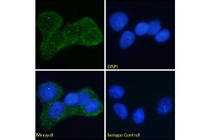 Immunofluorescence staining of fixed MCF7 cells with anti-Insulin receptor alpha antibody Fab 83-7. (Recombinant ISR-alpha 抗体)
