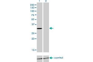 Western blot analysis of KCNIP2 over-expressed 293 cell line, cotransfected with KCNIP2 Validated Chimera RNAi (Lane 2) or non-transfected control (Lane 1). (KCNIP2 抗体  (AA 1-100))