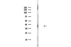 Western blot analysis of lysates from PC12 cells, using MEK4/MKK4 Antibody at 1/1000 dilution.