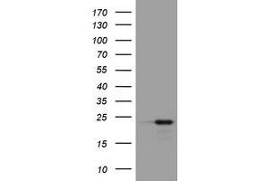 Image no. 1 for anti-Visinin-Like 1 (VSNL1) (AA 2-191) antibody (ABIN1491148) (VSNL1 抗体  (AA 2-191))