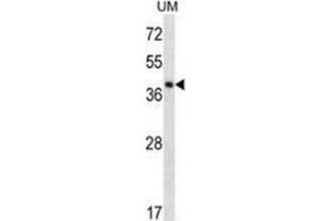 Western blot analysis in UM cell line lysates (35ug/lane) using SPOPL  Antibody .