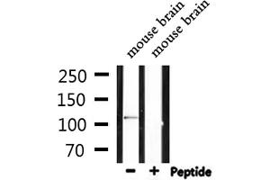 Western blot analysis of extracts from mouse brain, using IFIH1 Antibody. (IFIH1 抗体  (C-Term))