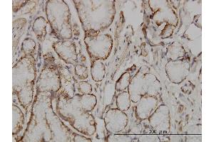 Immunoperoxidase of monoclonal antibody to SOCS5 on formalin-fixed paraffin-embedded human small Intestine. (SOCS5 抗体  (AA 1-110))