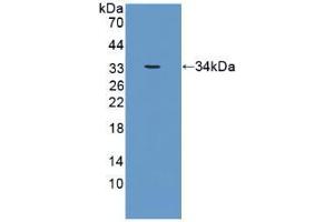 Western blot analysis of recombinant Human CRAT. (CRAT 抗体  (AA 363-626))