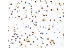 Immunohistochemistry of paraffin-embedded Mouse brain using FUBP1 Polyclonal Antibody at dilution of 1:100 (40x lens). (FUBP1 抗体)