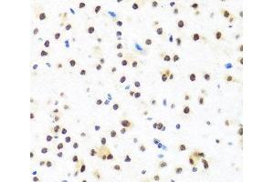 Immunohistochemistry of paraffin-embedded Mouse brain using FUBP1 Polyclonal Antibody at dilution of 1:100 (40x lens). (FUBP1 抗体)