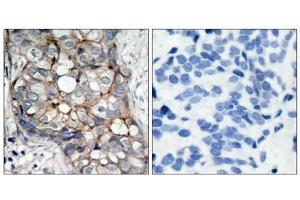 Immunohistochemical analysis of paraffin- embedded human breast carcinoma tissue using (EGFR 抗体)