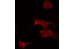 ABIN6267318 staining COS7 by IF/ICC. (Progesterone Receptor 抗体  (pSer294))