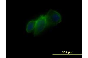Immunofluorescence of monoclonal antibody to CDH11 on PC3-MM2 cell. (OB Cadherin 抗体  (AA 54-612))