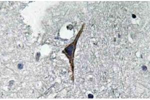 Immunohistochemistry (IHC) analyzes of NOS3 antibody in paraffin-embedded human brain tissue. (ENOS 抗体)