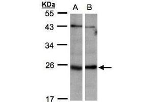 WB Image Sample(30 ug whole cell lysate) A:293T B:Hep G2 , 12% SDS PAGE antibody diluted at 1:1000 (ITPA 抗体)