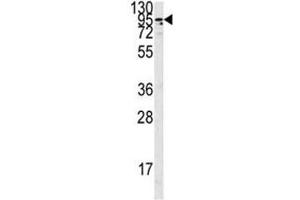 Western Blotting (WB) image for anti-Angiotensin I Converting Enzyme 2 (ACE2) (AA 773-805) antibody (ABIN3029965)