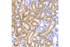 Immunohistochemistry (Paraffin-embedded Sections) (IHC (p)) image for anti-Ribophorin 1 (RPN1) (AA 20-280) antibody (ABIN6147171)