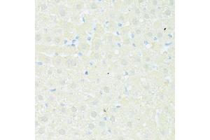 Immunohistochemistry of paraffin-embedded rat liver using TRIM15 antibody (ABIN5999102) at dilution of 1/100 (40x lens). (TRIM15 抗体)