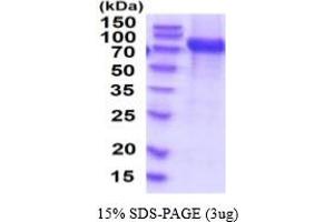 SDS-PAGE (SDS) image for Vascular Cell Adhesion Molecule 1 (VCAM1) (AA 25-698) (Active) protein (His tag) (ABIN5854738) (VCAM1 Protein (AA 25-698) (His tag))