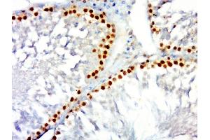Immunohistochemistry (Paraffin-embedded Sections) (IHC (p)) image for anti-Proliferating Cell Nuclear Antigen (PCNA) (AA 201-261) antibody (ABIN676598)