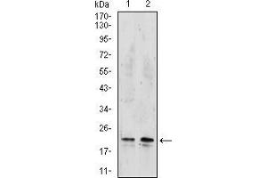 Western Blotting (WB) image for anti-Nucleoside diphosphate kinase B (NME2) (AA 1-152) antibody (ABIN5542536)