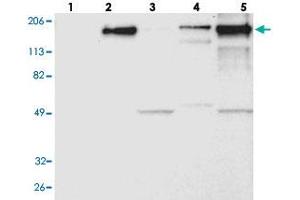 Western blot analysis of Lane 1: RT-4, Lane 2: U-251 MG, Lane 3: A-431, Lane 4: Liver, Lane 5: Tonsil with LAMB2 polyclonal antibody . (LAMB2 抗体)