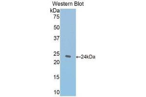 Western Blotting (WB) image for anti-Thrombospondin 1 (THBS1) (AA 61-259) antibody (ABIN1173301)