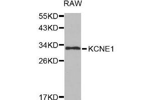 Western blot analysis of extracts of RAW cell line, using KCNE1 antibody. (KCNE1 抗体  (AA 1-100))