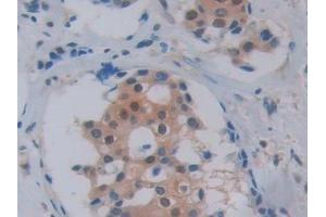Immunohistochemistry (IHC) image for anti-Pancreas Specific Transcription Factor, 1a (PTF1A) (AA 177-328) antibody (ABIN7435103)