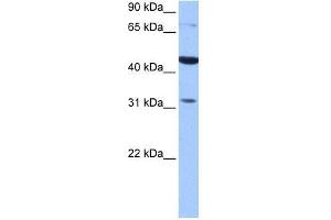 TPRXL antibody used at 0. (TPRXL 抗体  (C-Term))