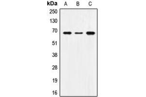 Western blot analysis of SNX1 expression in MCF7 (A), SP2/0 (B), H9C2 (C) whole cell lysates.