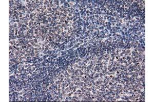 Immunohistochemical staining of paraffin-embedded Human lymph node tissue using anti-EIF1 mouse monoclonal antibody. (EIF1 抗体)