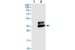 Western blot analysis of Lane 1: Negative control (vector only transfected HEK293T lysate), Lane 2: Over-expression Lysate (Co-expressed with a C-terminal myc-DDK tag (~3. (CEACAM1 抗体)